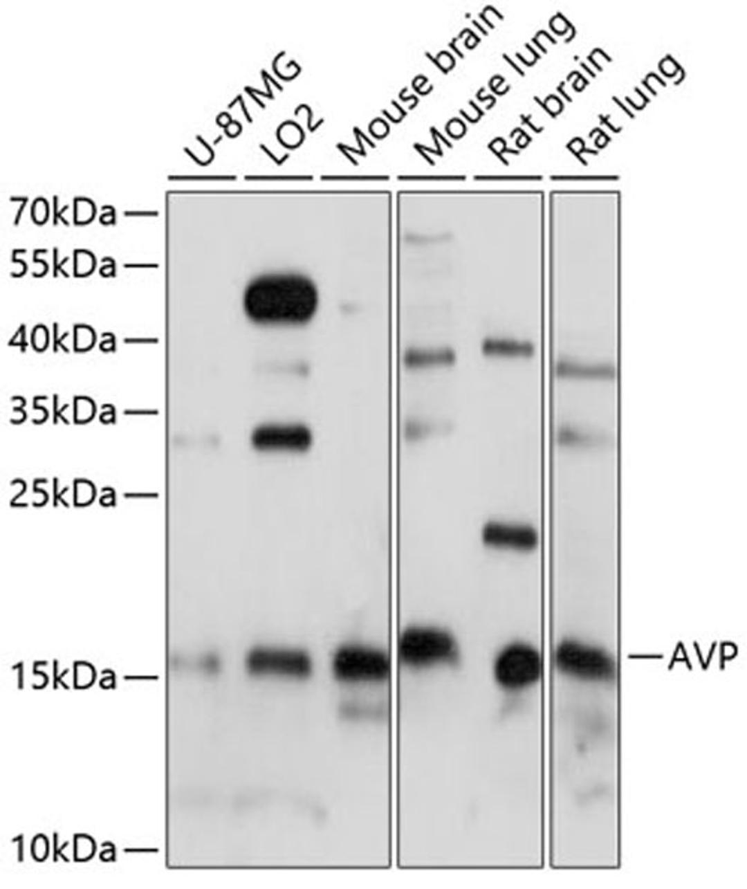 Western blot - AVP antibody (A1725)