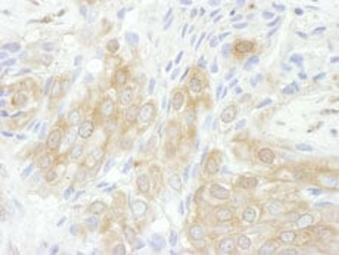 Detection of human 14-3-3-theta by immunohistochemistry.