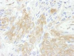 Detection of human 14-3-3-theta by immunohistochemistry.