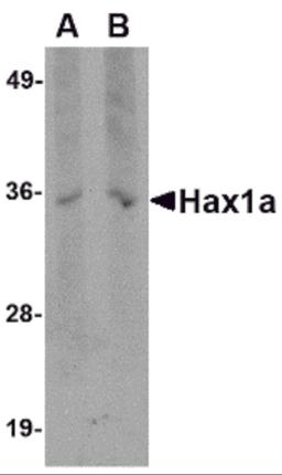 Western blot analysis of Hax1a in human brain tissue lysate with Hax1a antibody at (A) 1 and (B) 2 &#956;g/mL.