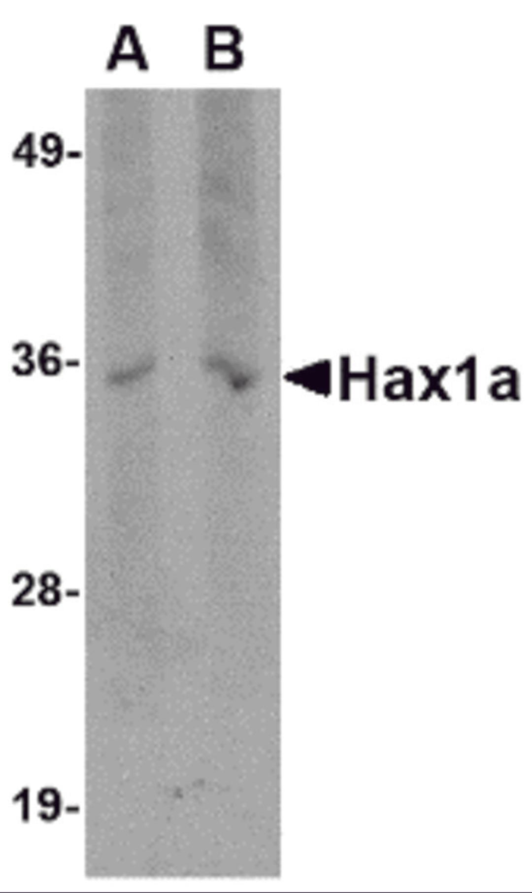 Western blot analysis of Hax1a in human brain tissue lysate with Hax1a antibody at (A) 1 and (B) 2 μg/mL.