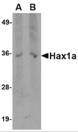 Western blot analysis of Hax1a in human brain tissue lysate with Hax1a antibody at (A) 1 and (B) 2 μg/mL.