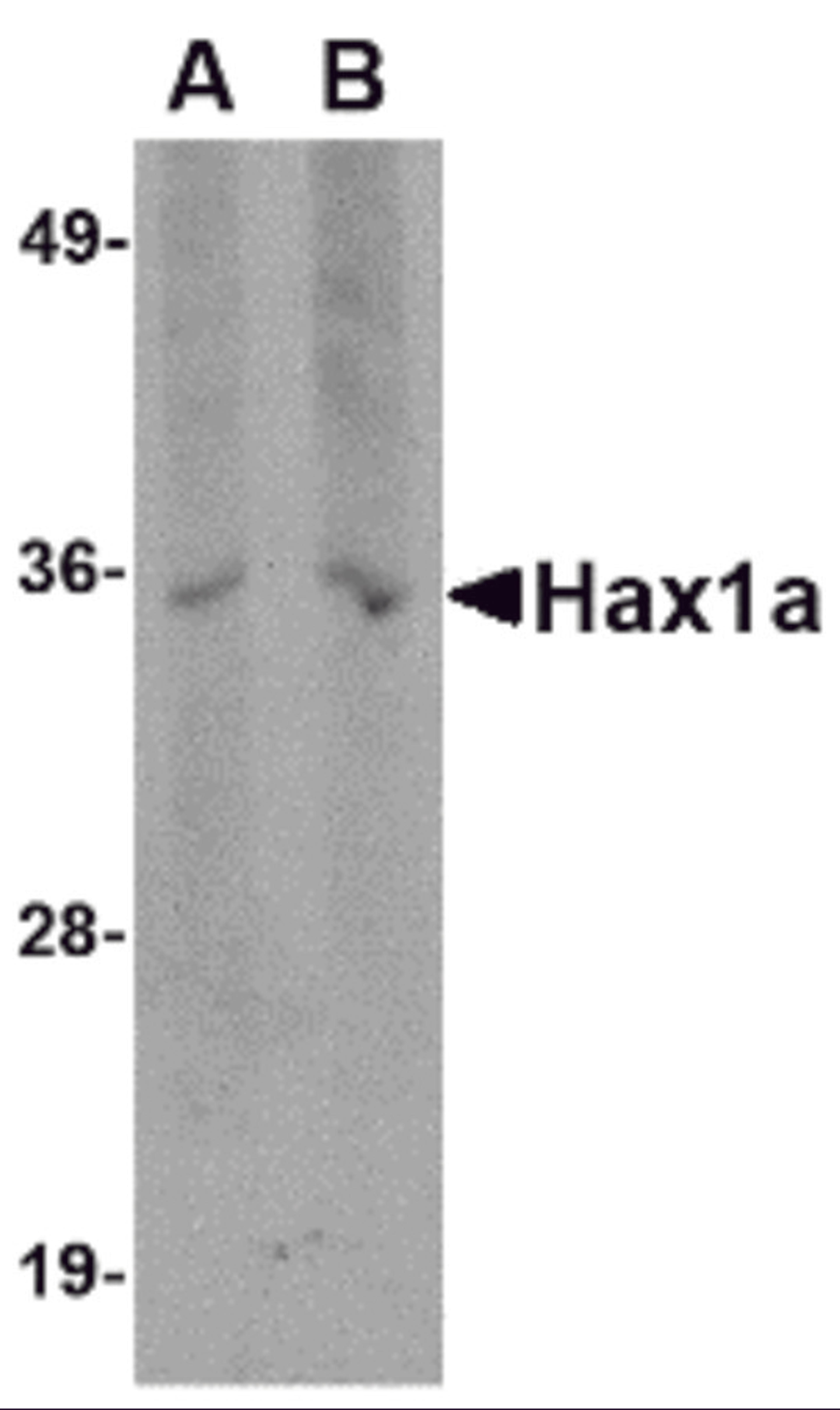 Western blot analysis of Hax1a in human brain tissue lysate with Hax1a antibody at (A) 1 and (B) 2 μg/mL.