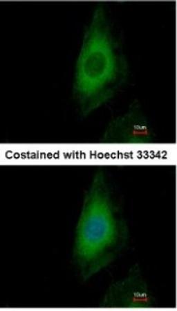 Immunocytochemistry/Immunofluorescence: PPP2CB Antibody [NBP1-32069] - Paraformaldehyde-fixed HeLa, using antibody at 1:500 dilution.