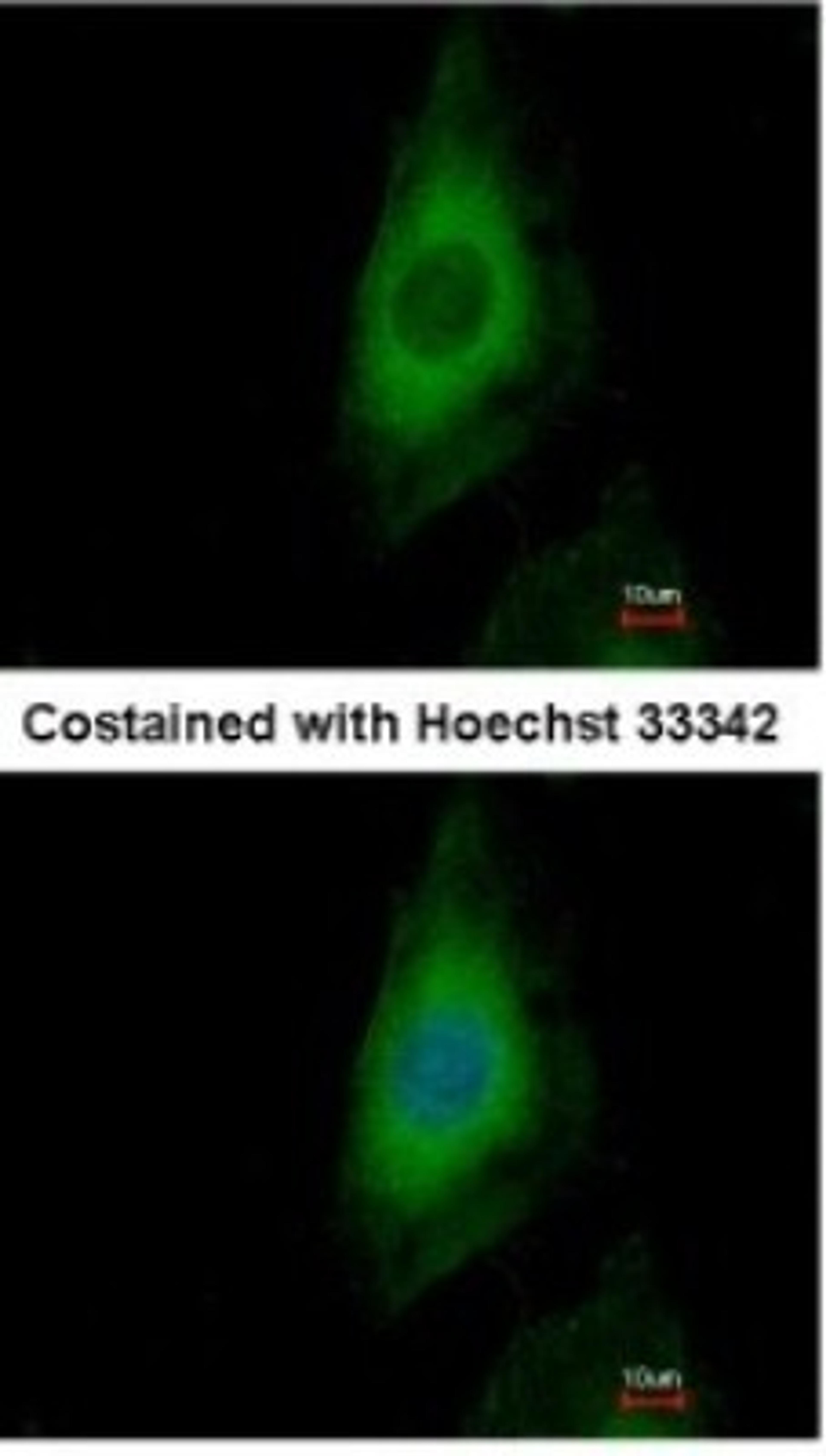 Immunocytochemistry/Immunofluorescence: PPP2CB Antibody [NBP1-32069] - Paraformaldehyde-fixed HeLa, using antibody at 1:500 dilution.