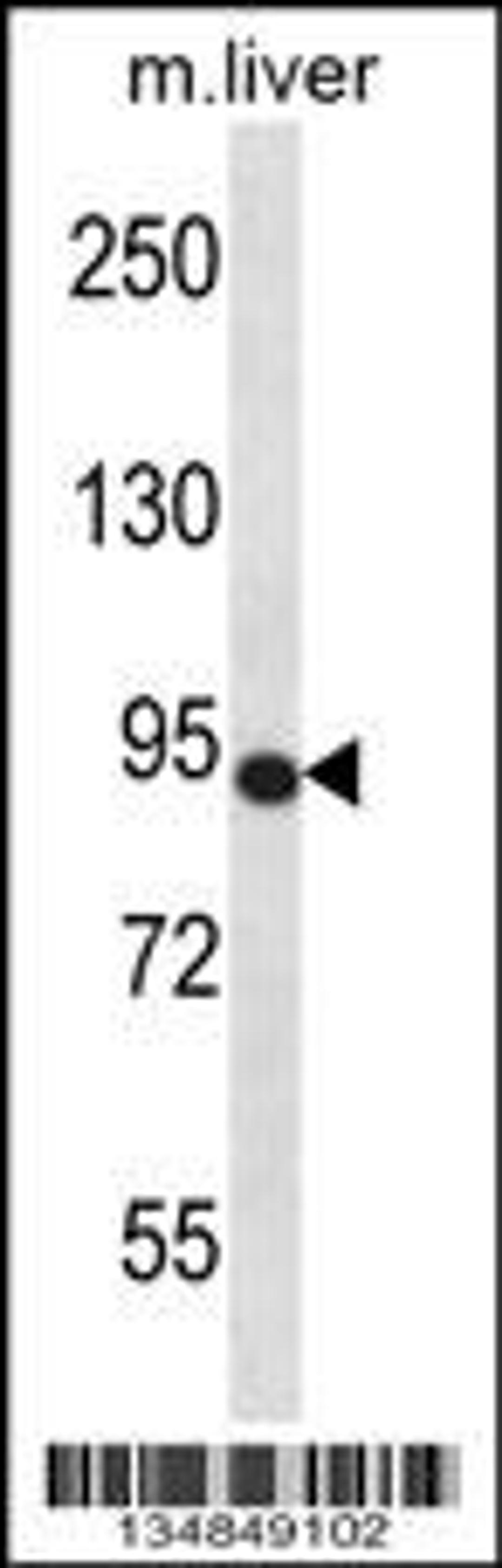 Western blot analysis in mouse liver tissue lysates (35ug/lane).