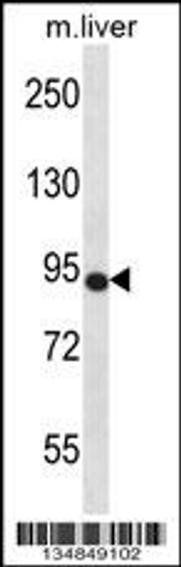 Western blot analysis in mouse liver tissue lysates (35ug/lane).