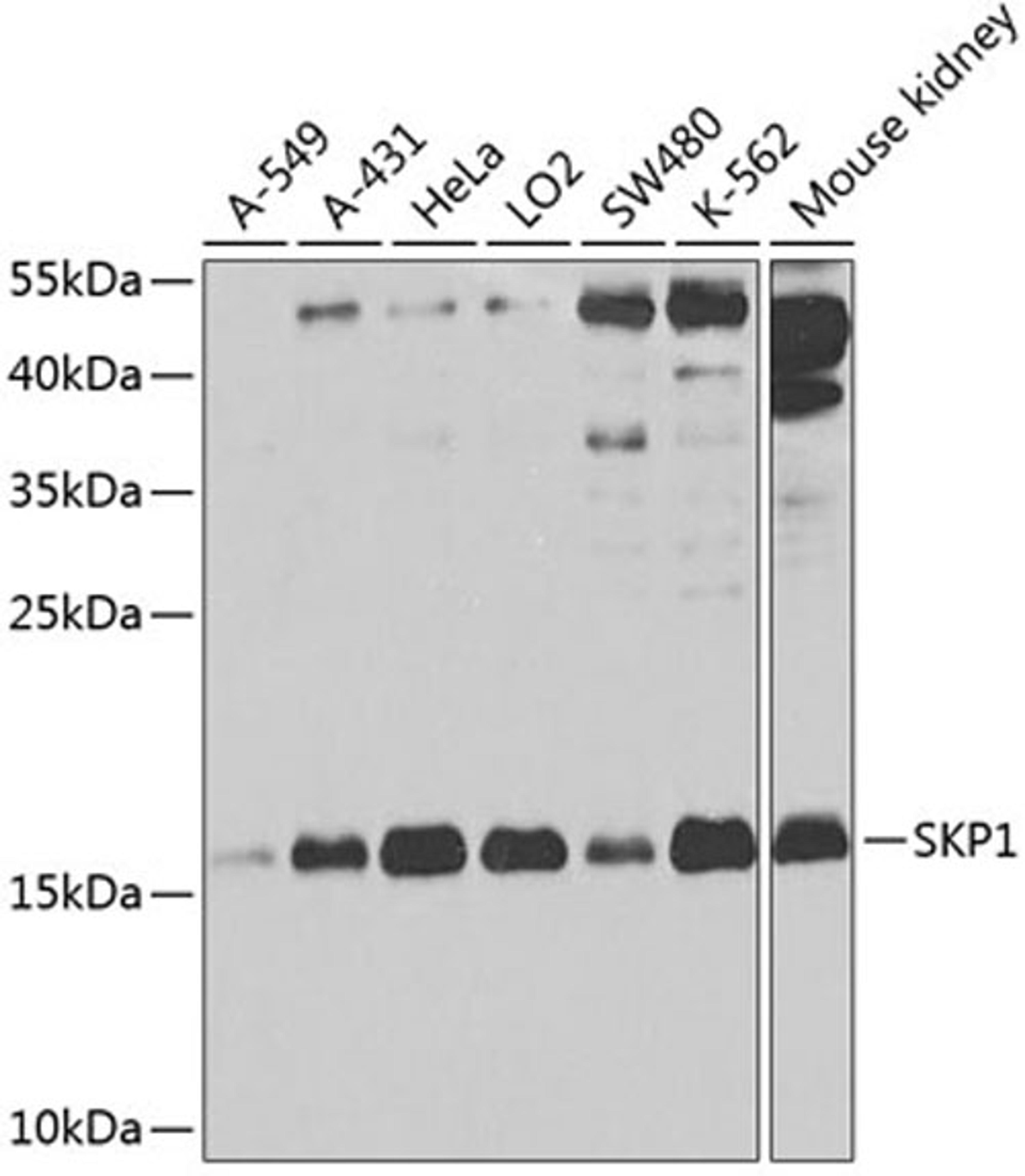 Western blot - SKP1 antibody (A2566)