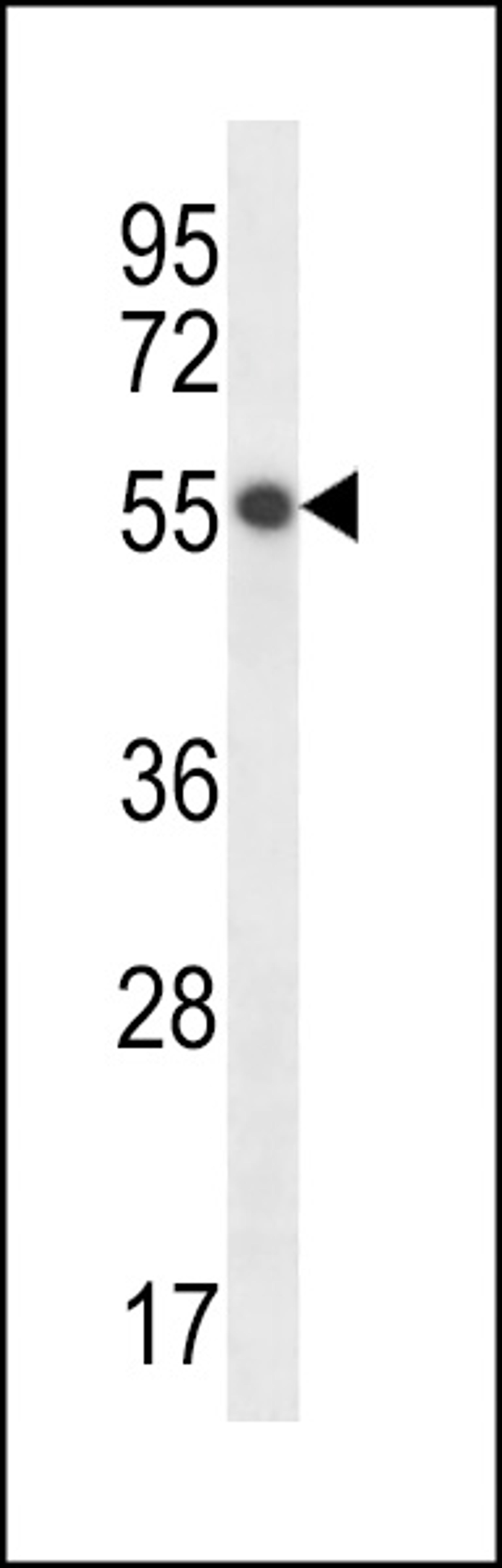 Western blot analysis in HepG2 cell line lysates (35ug/lane).