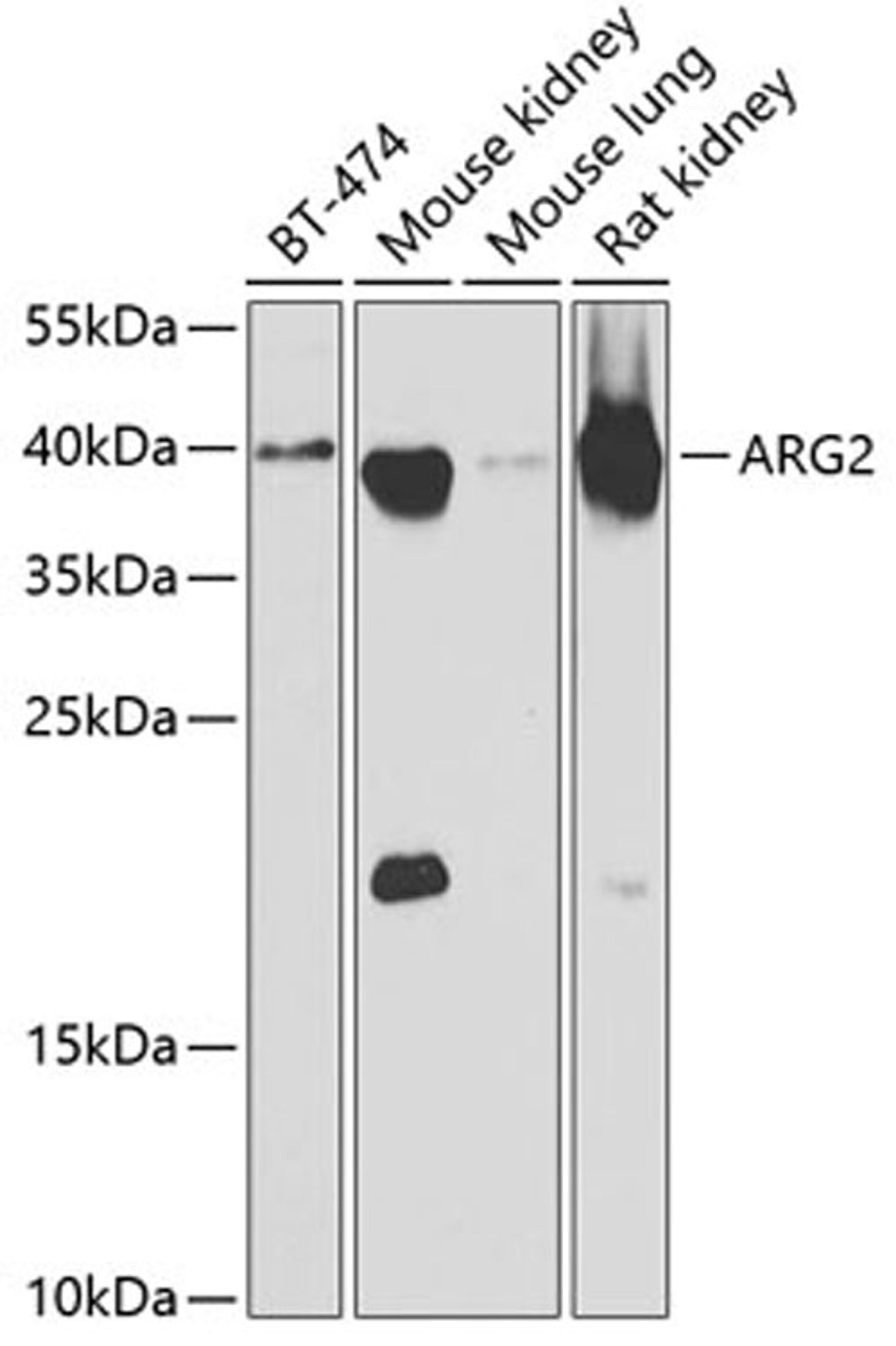 Western blot - ARG2 antibody (A6355)