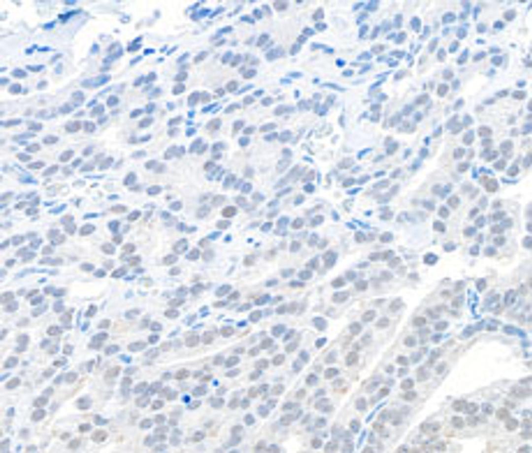 Detection of human EMSY by immunohistochemistry.