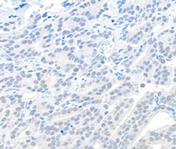 Detection of human EMSY by immunohistochemistry.