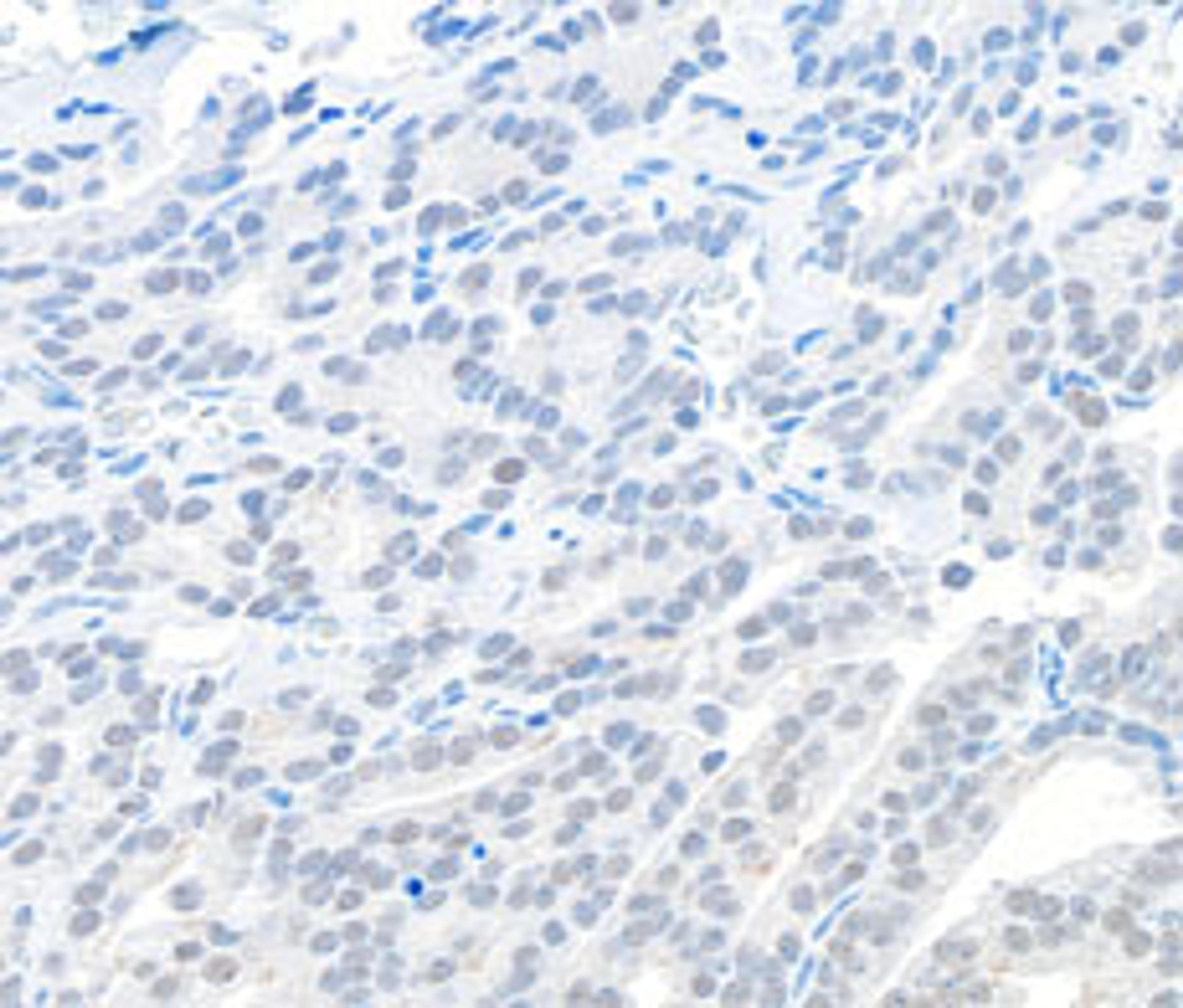 Detection of human EMSY by immunohistochemistry.