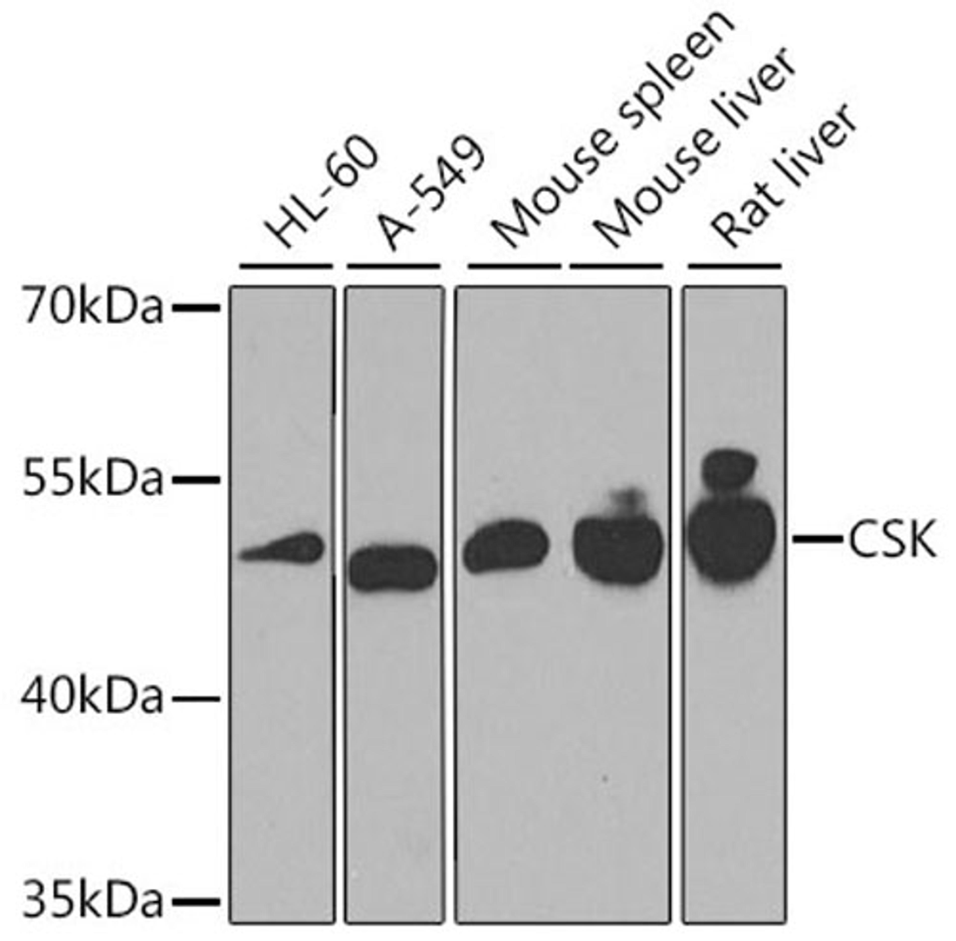 Western blot - CSK antibody (A0735)