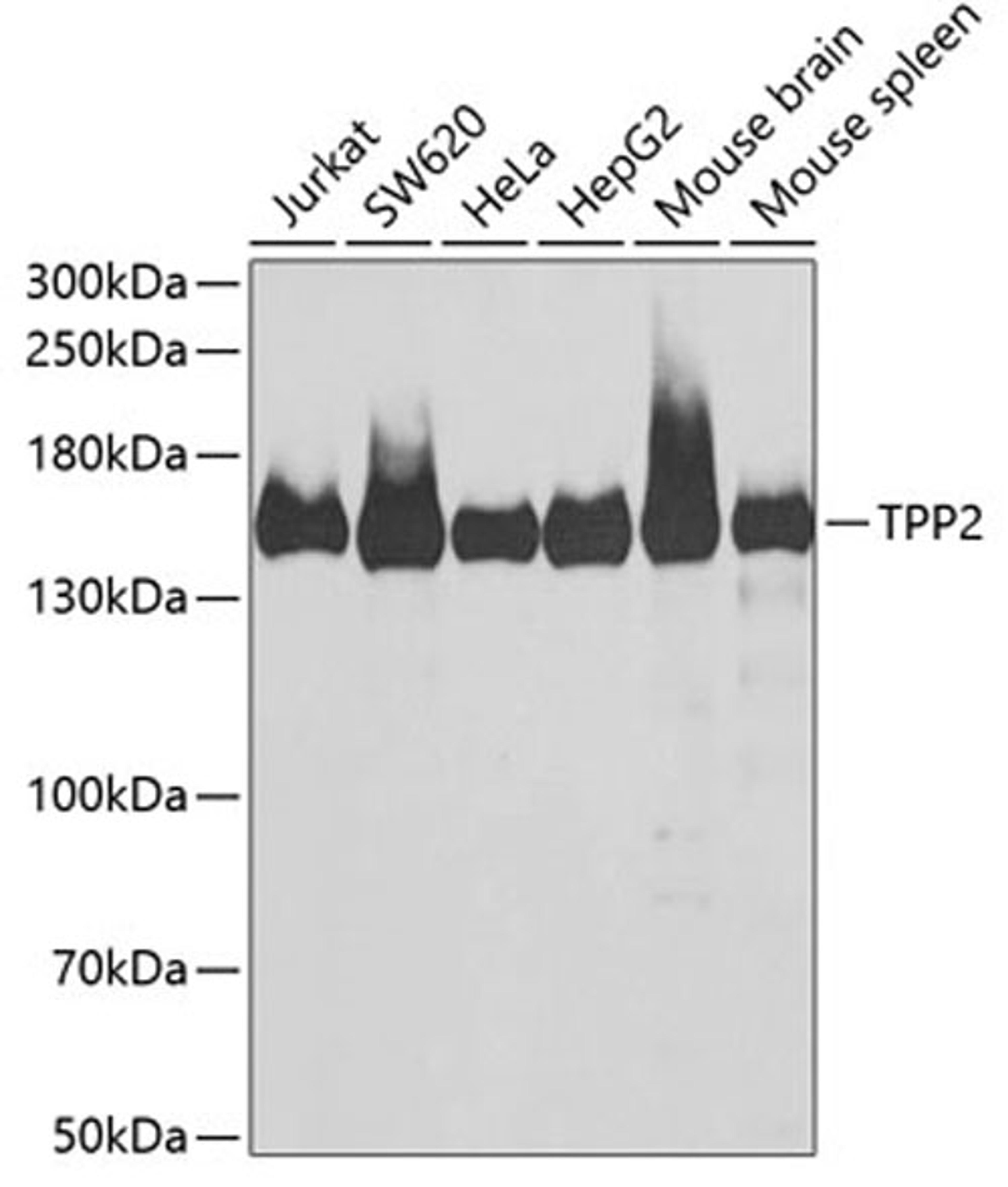 Western blot - TPP2 antibody (A6421)