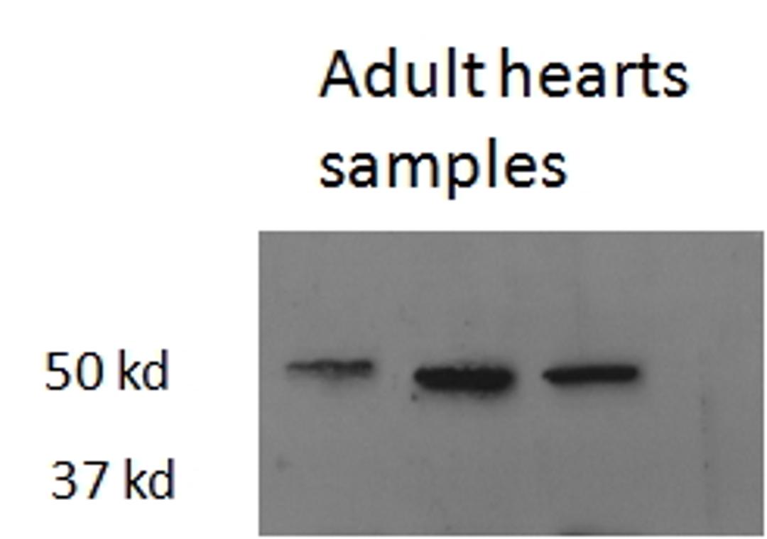 46-488 (2.5ug/ml) staining of Zebrafish adult Heart lysate (35ug protein in RIPA buffer). Primary incubation was 1 hour. Detected by chemiluminescence.