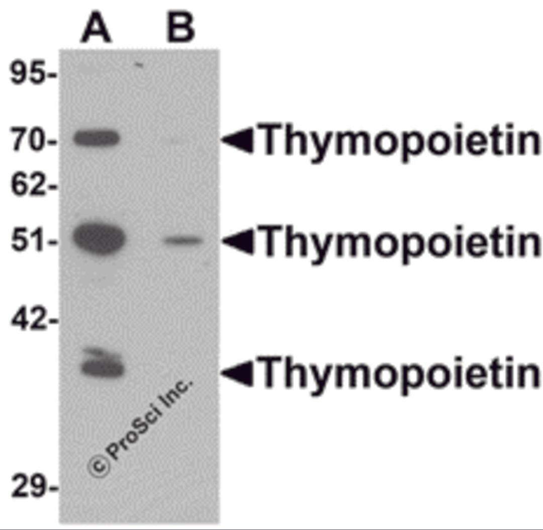 Western blot analysis of Thymopoietin in HeLa cell lysate with Thymopoietin antibody at 0.25 &#956;g/mLl in (A) the absence and (B) the presence of blocking peptide.