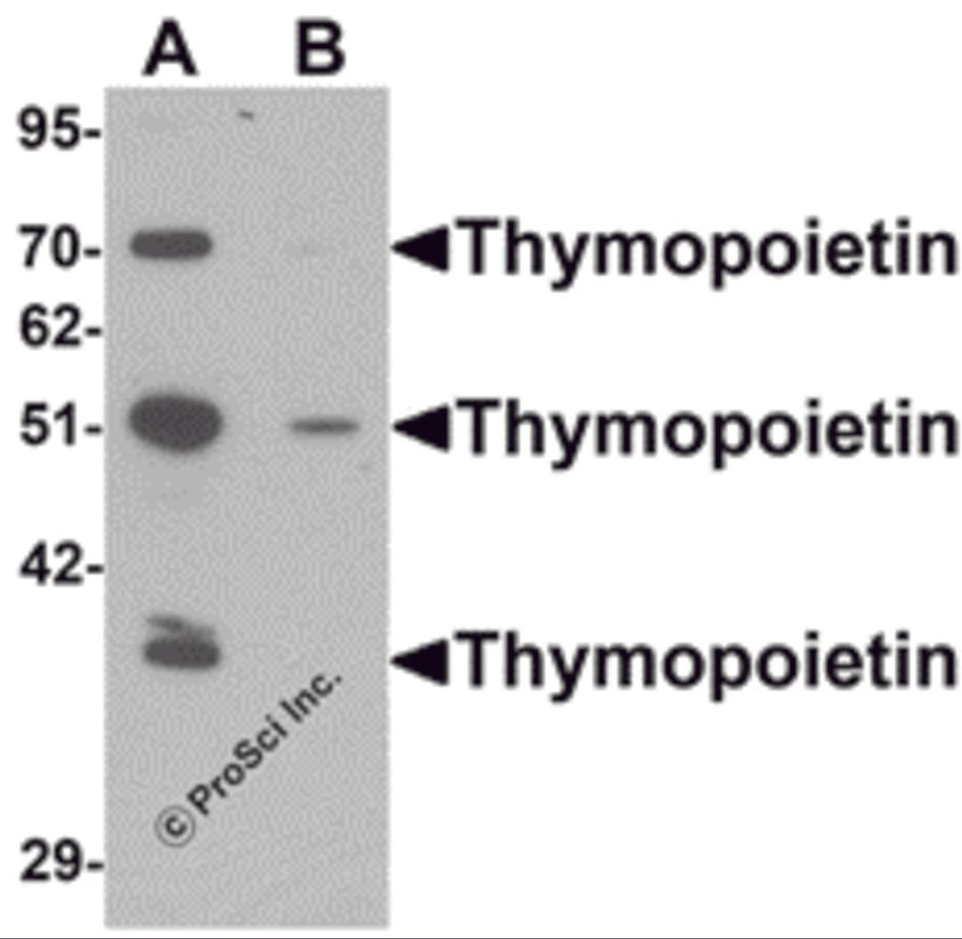 Western blot analysis of Thymopoietin in HeLa cell lysate with Thymopoietin antibody at 0.25 μg/mLl in (A) the absence and (B) the presence of blocking peptide.