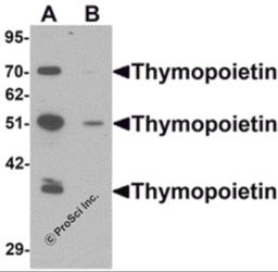 Western blot analysis of Thymopoietin in HeLa cell lysate with Thymopoietin antibody at 0.25 μg/mLl in (A) the absence and (B) the presence of blocking peptide.