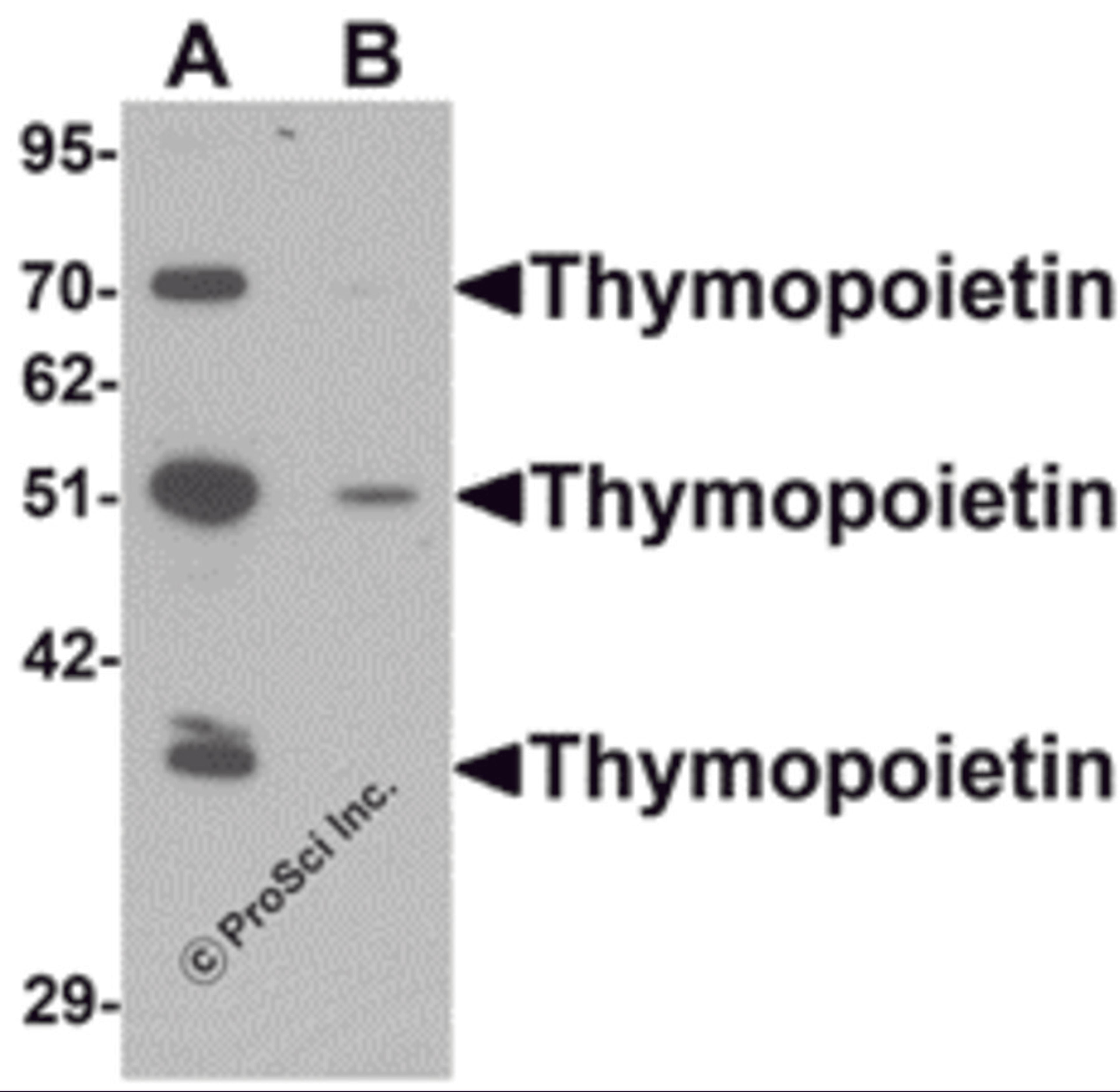 Western blot analysis of Thymopoietin in HeLa cell lysate with Thymopoietin antibody at 0.25 μg/mLl in (A) the absence and (B) the presence of blocking peptide.