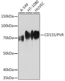 Western blot - CD155/PVR Rabbit mAb (A5138)