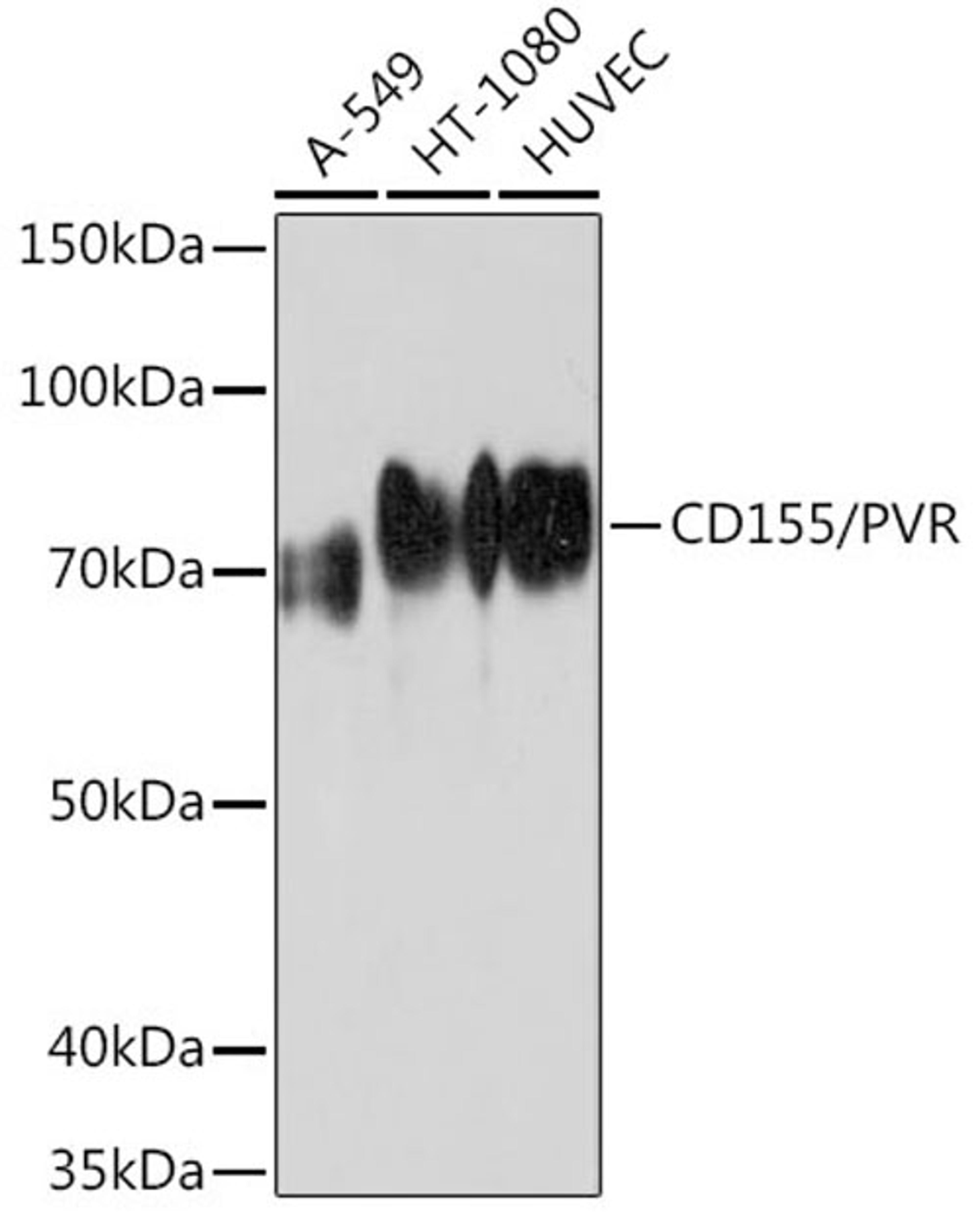 Western blot - CD155/PVR Rabbit mAb (A5138)