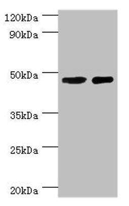 Western blot. All lanes: SMAD3 antibody at 8ug/ml. Lane 1: Jurkat whole cell lysate. Lane 2: A431 whole cell lysate. Secondary. Goat polyclonal to rabbit IgG at 1/10000 dilution. Predicted band size: 49, 44, 36, 26 kDa. Observed band size: 49 kDa. 