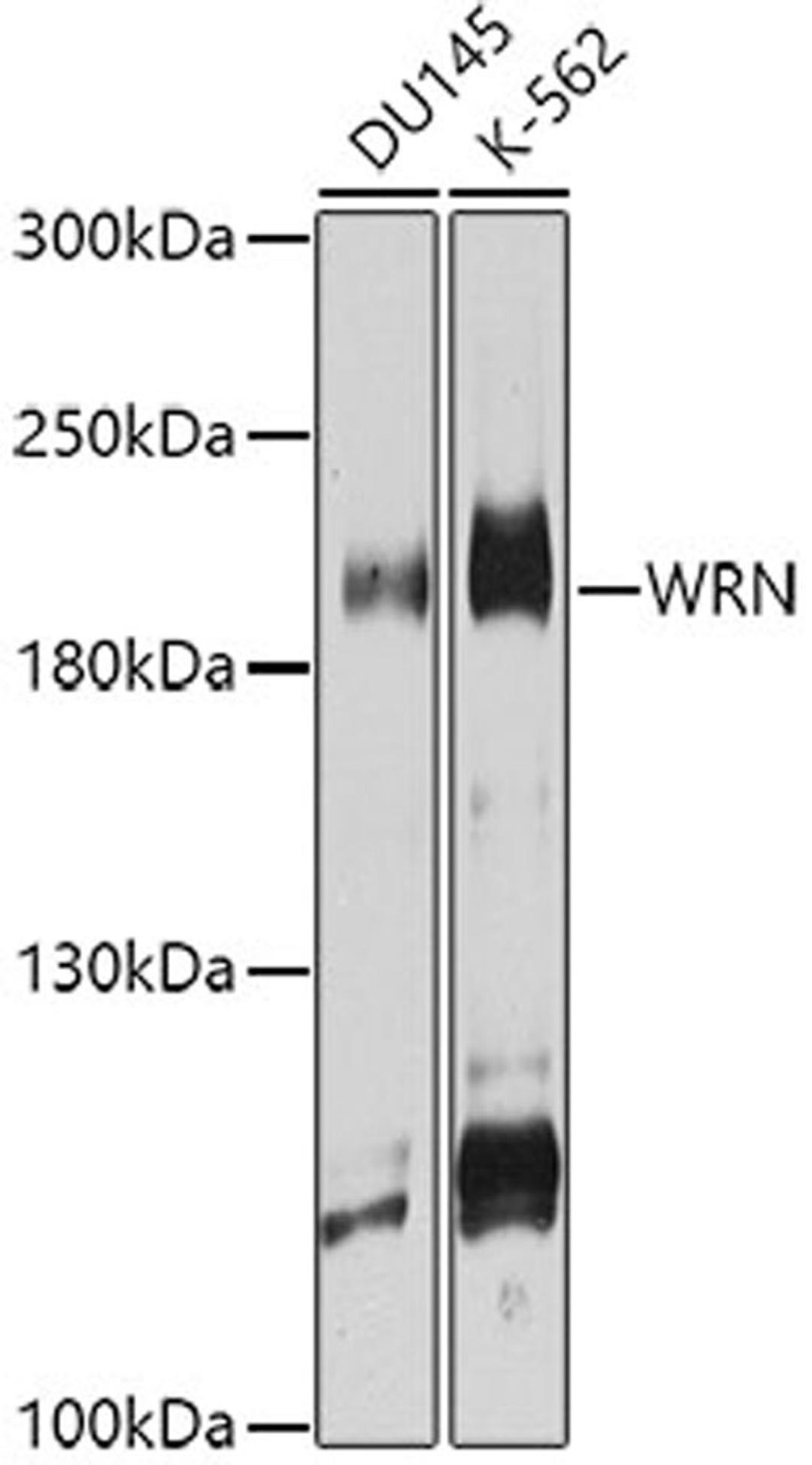 Western blot - WRN antibody (A6855)