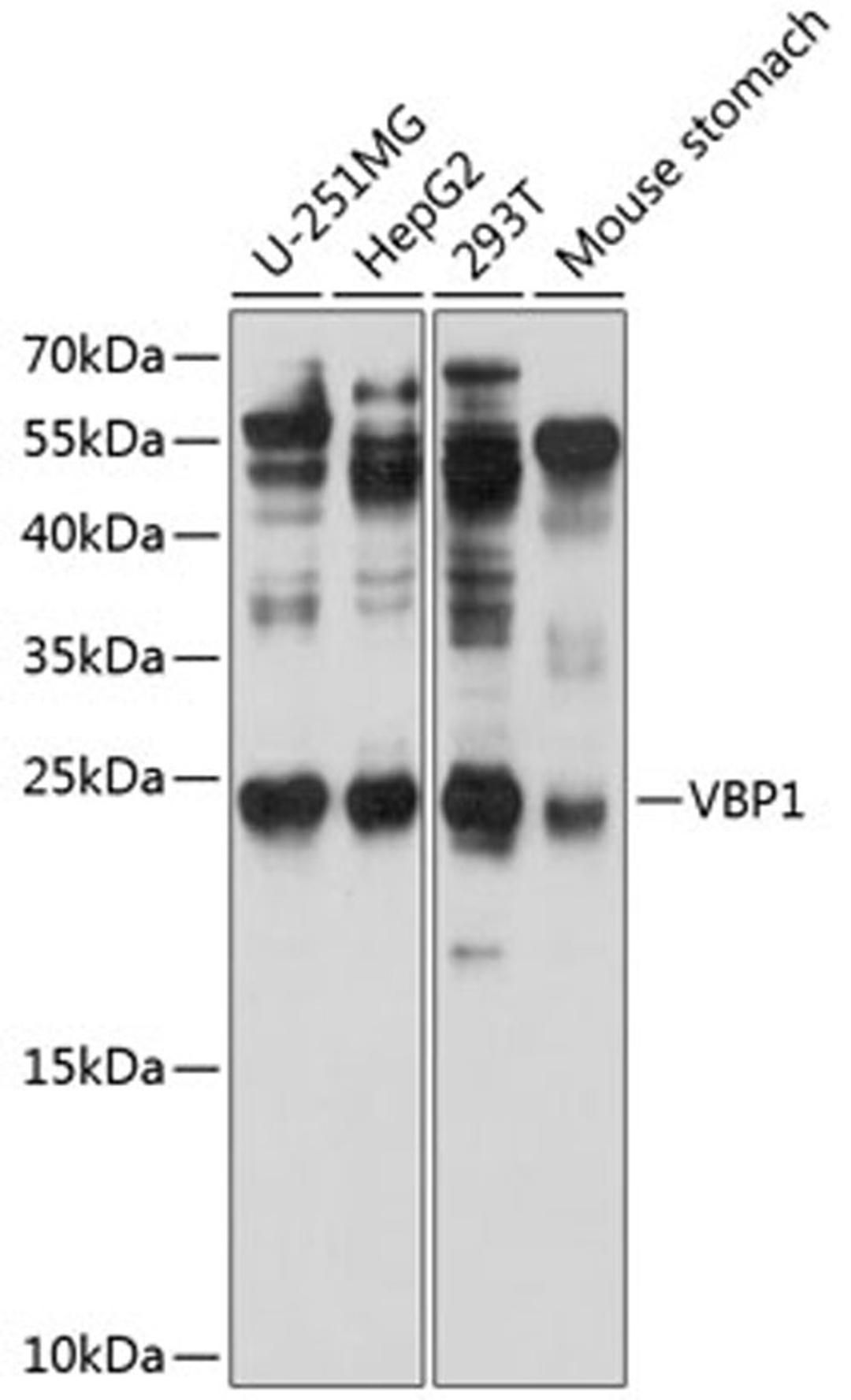 Western blot - VBP1 antibody (A8990)