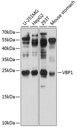 Western blot - VBP1 antibody (A8990)