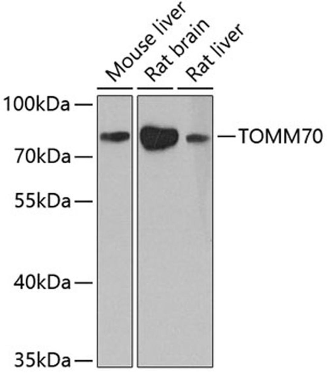 Western blot - TOMM70 antibody (A4349)