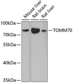 Western blot - TOMM70 antibody (A4349)