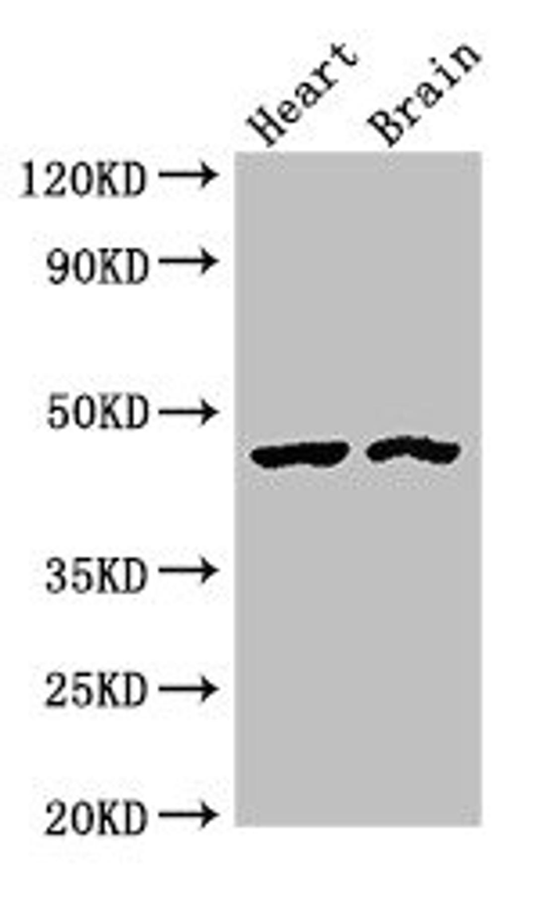 Western Blot. Positive WB detected in: Rat heart tissue, Mouse brain tissue. All lanes: CTH antibody at 4ug/ml. Secondary. Goat polyclonal to rabbit IgG at 1/50000 dilution. Predicted band size: 45, 40, 42 kDa. Observed band size: 45 kDa. 