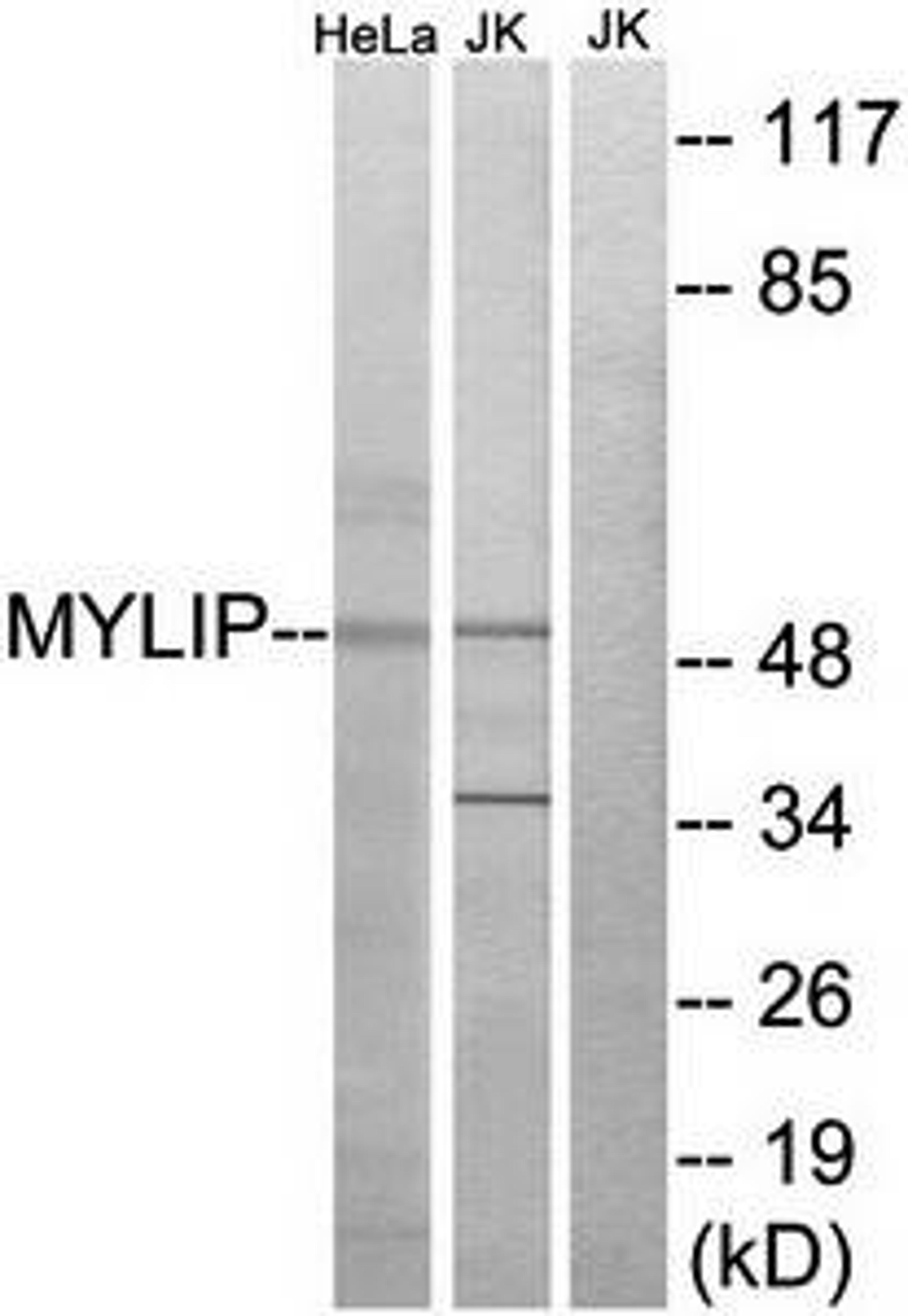 Western blot analysis of extracts from HeLa cells and Jurkat cells using MYLIP antibody