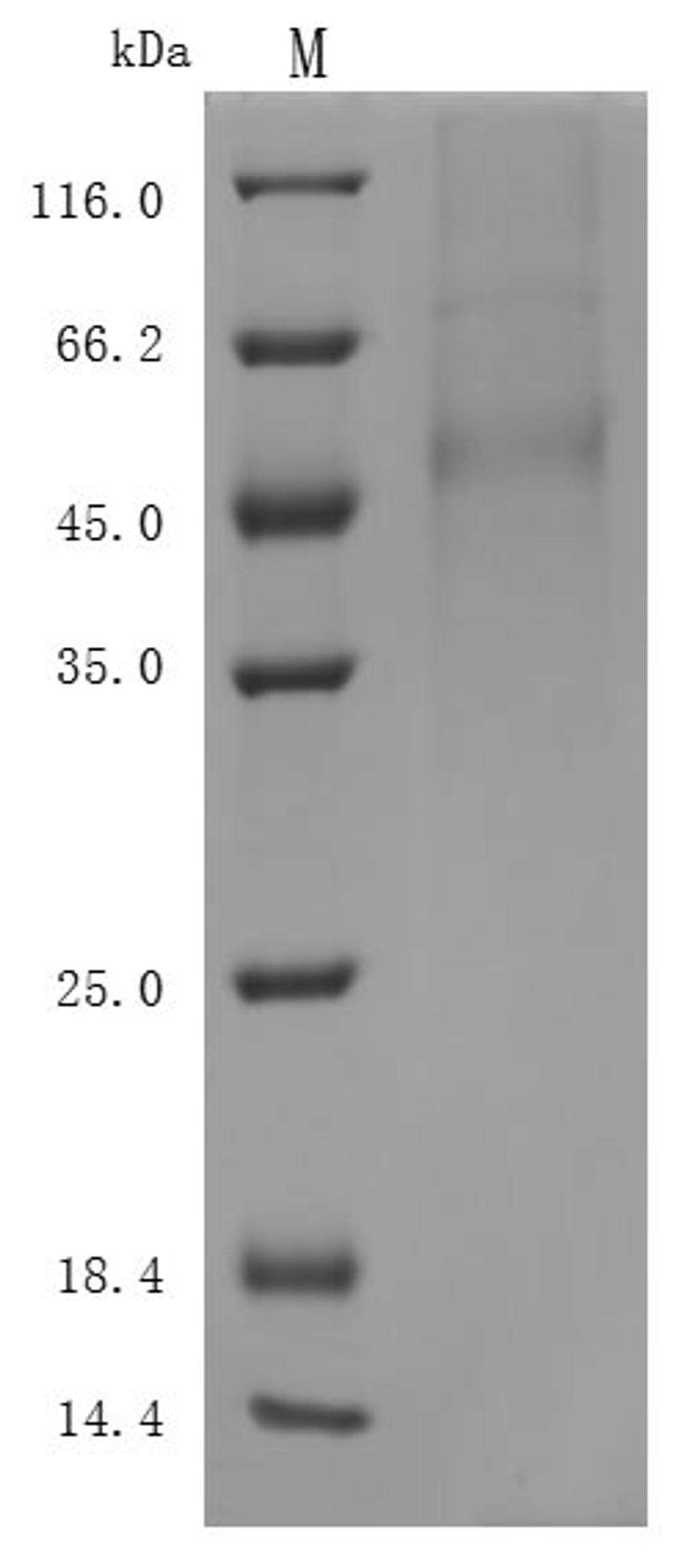 (Tris-Glycine gel) Discontinuous SDS-PAGE (reduced) with 5% enrichment gel and 15% separation gel.