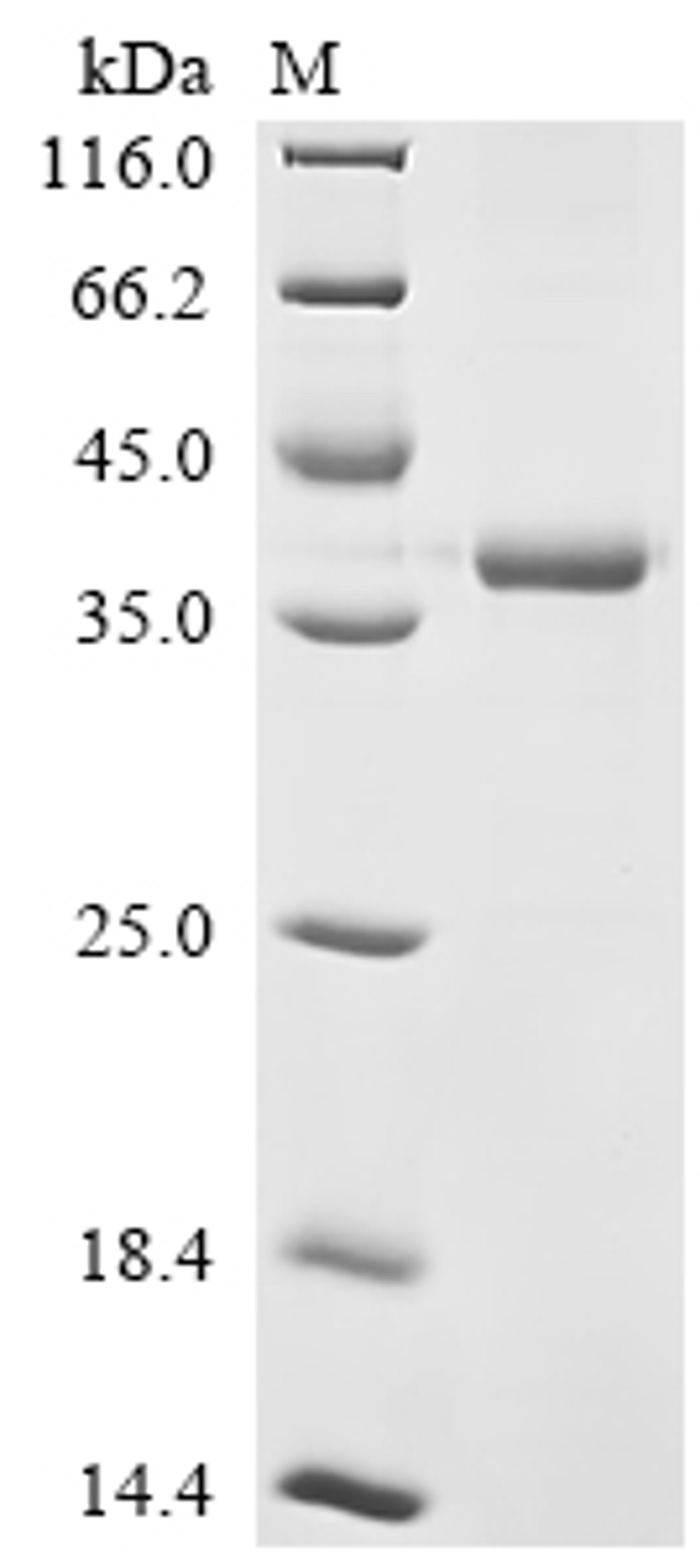 (Tris-Glycine gel) Discontinuous SDS-PAGE (reduced) with 5% enrichment gel and 15% separation gel.