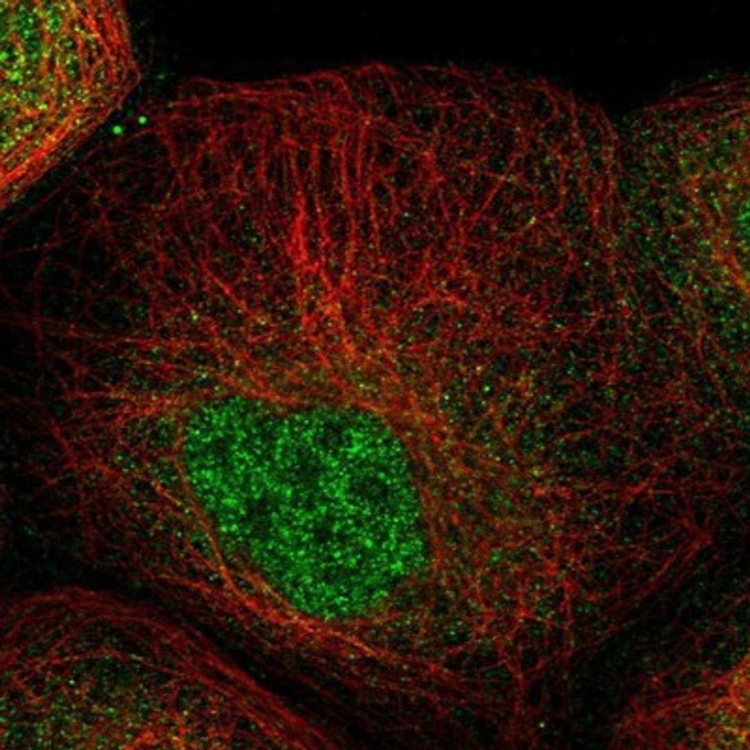 Immunocytochemistry/Immunofluorescence: ZNF641 Antibody [NBP1-82022] - Staining of human cell line A-431 shows positivity in nucleus but not nucleoli.