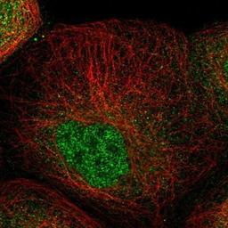 Immunocytochemistry/Immunofluorescence: ZNF641 Antibody [NBP1-82022] - Staining of human cell line A-431 shows positivity in nucleus but not nucleoli.