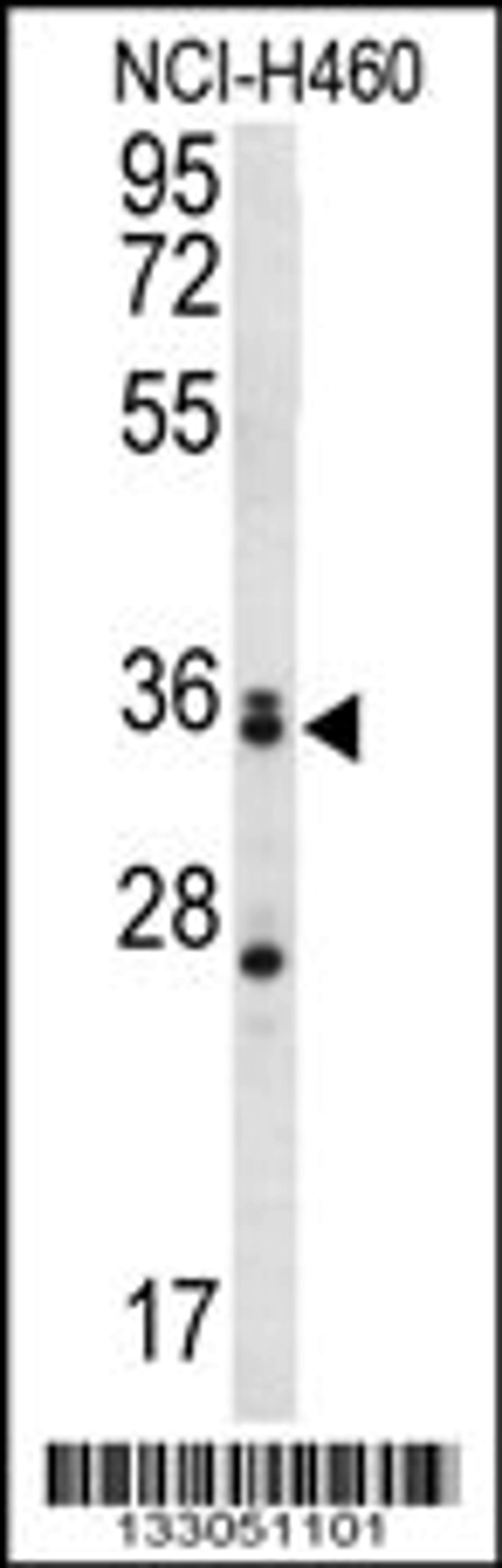 Western blot analysis in NCI-H460 cell line lysates (35ug/lane).