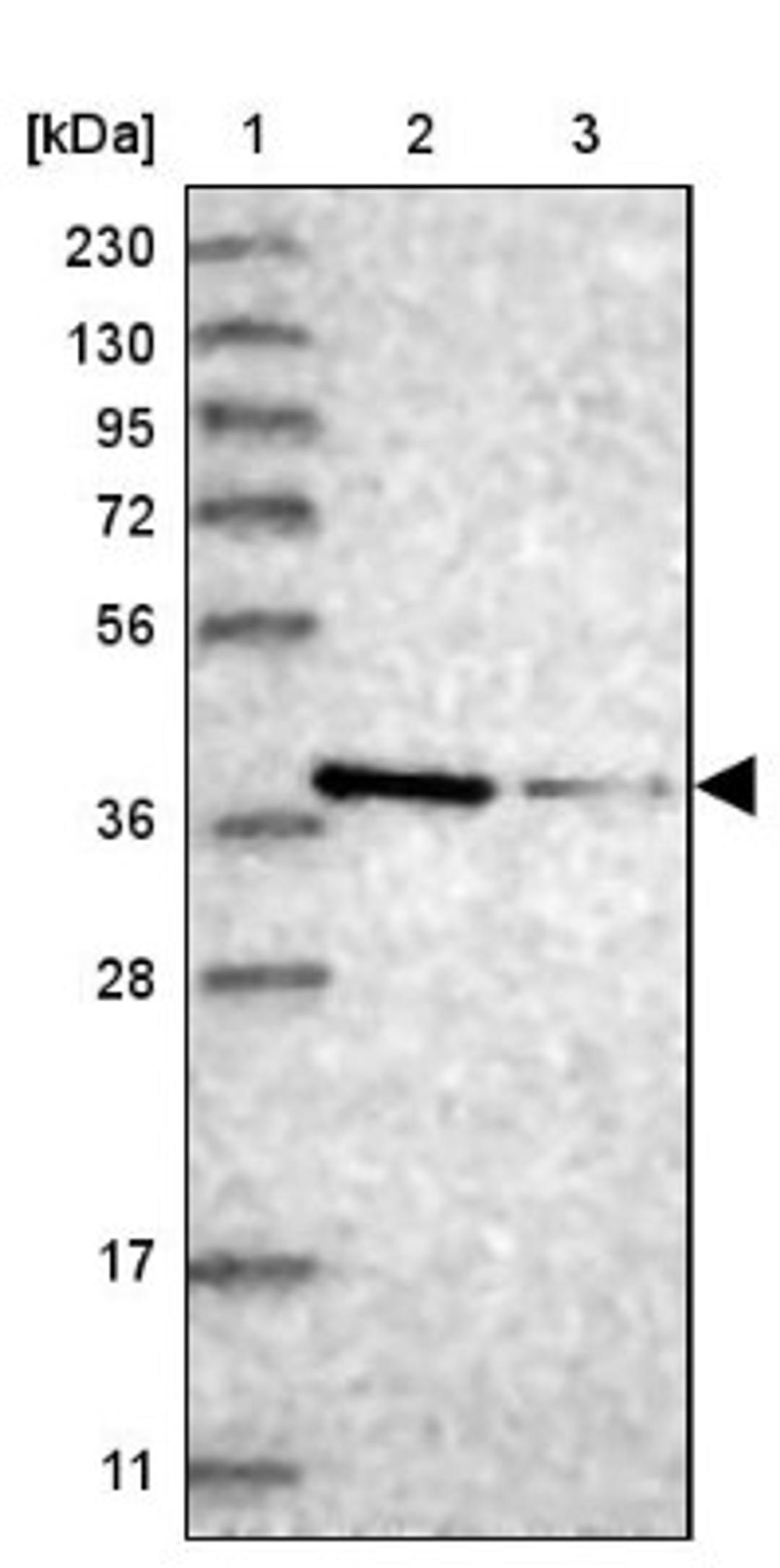 Western Blot: MAT2B Antibody [NBP1-82797] - Lane 1: Marker [kDa] 230, 130, 95, 72, 56, 36, 28, 17, 11<br/>Lane 2: Human cell line RT-4<br/>Lane 3: Human cell line U-251MG sp