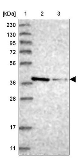 Western Blot: MAT2B Antibody [NBP1-82797] - Lane 1: Marker [kDa] 230, 130, 95, 72, 56, 36, 28, 17, 11<br/>Lane 2: Human cell line RT-4<br/>Lane 3: Human cell line U-251MG sp