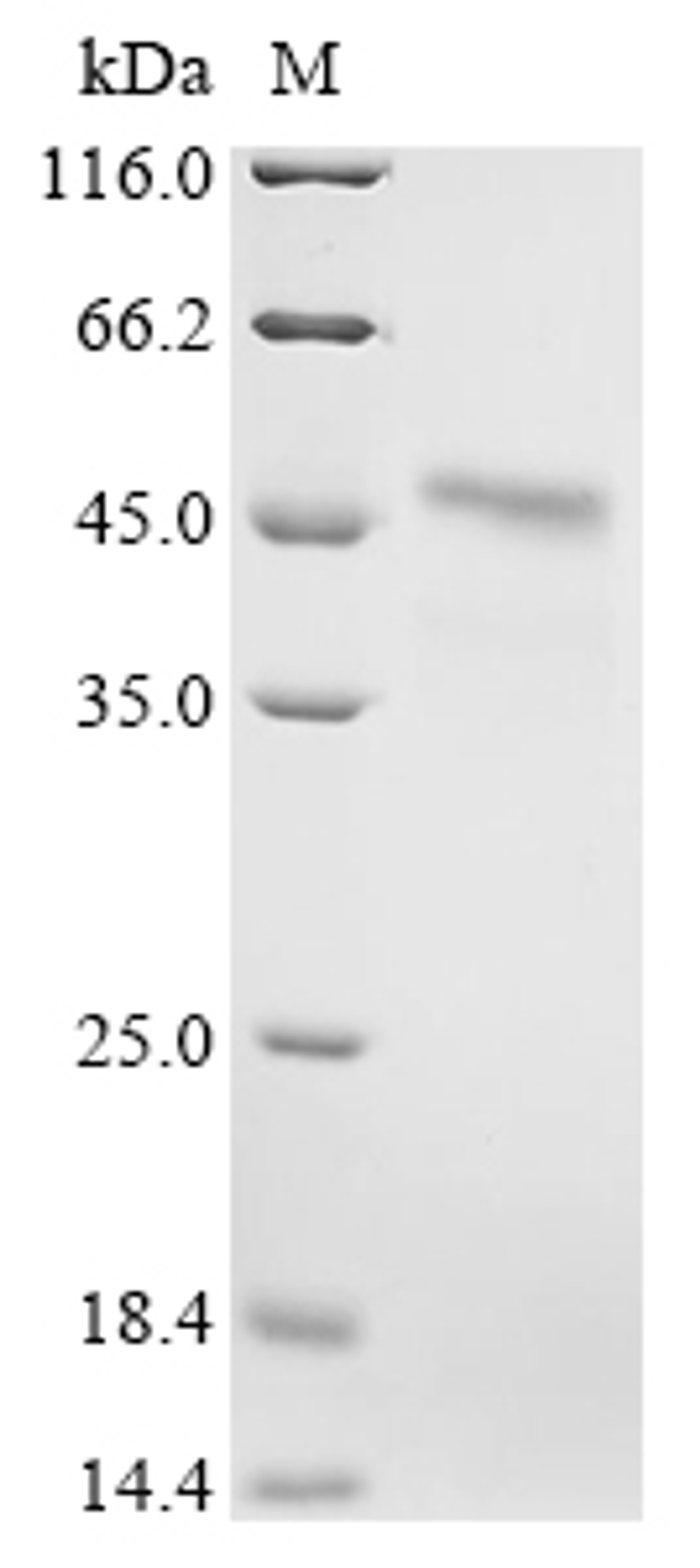 (Tris-Glycine gel) Discontinuous SDS-PAGE (reduced) with 5% enrichment gel and 15% separation gel.