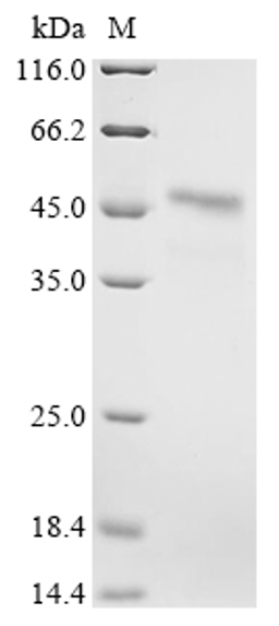 (Tris-Glycine gel) Discontinuous SDS-PAGE (reduced) with 5% enrichment gel and 15% separation gel.