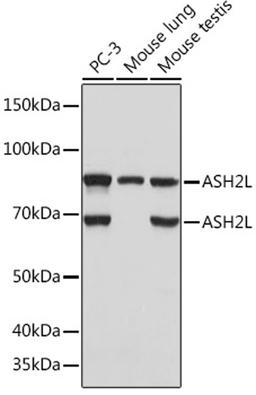 Western blot - ASH2L Rabbit mAb (A4892)