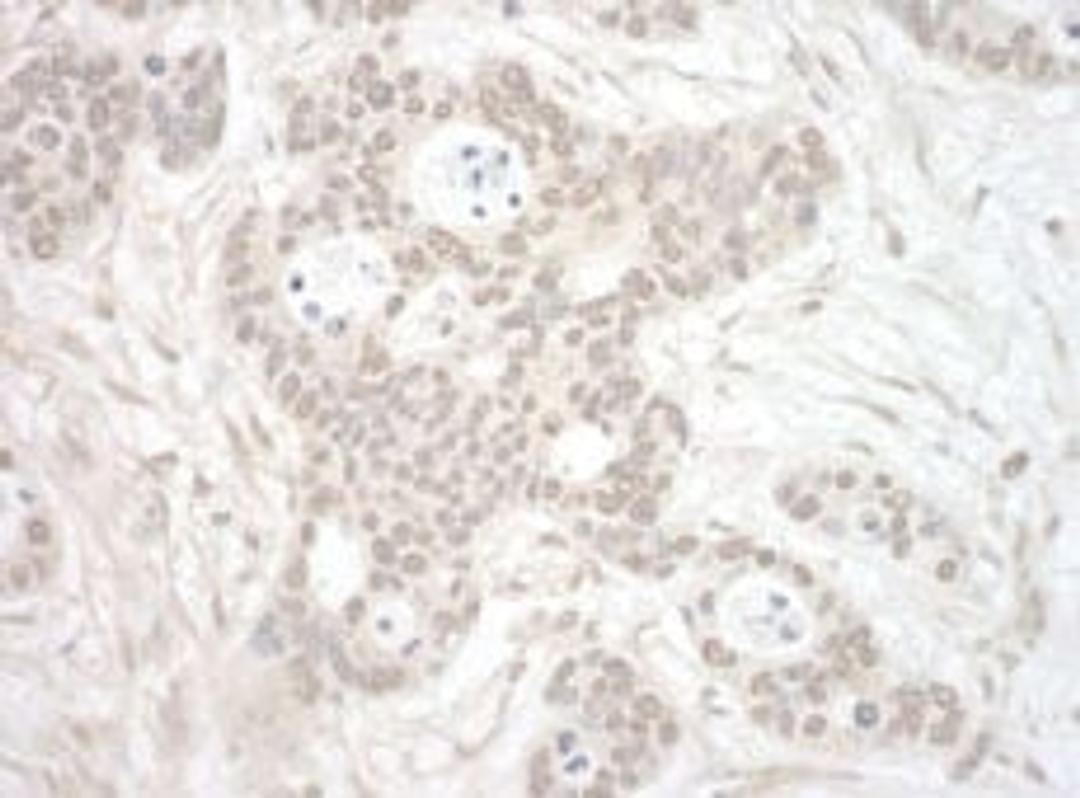 Detection of human ORC3 by immunohistochemistry.