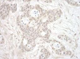 Detection of human ORC3 by immunohistochemistry.