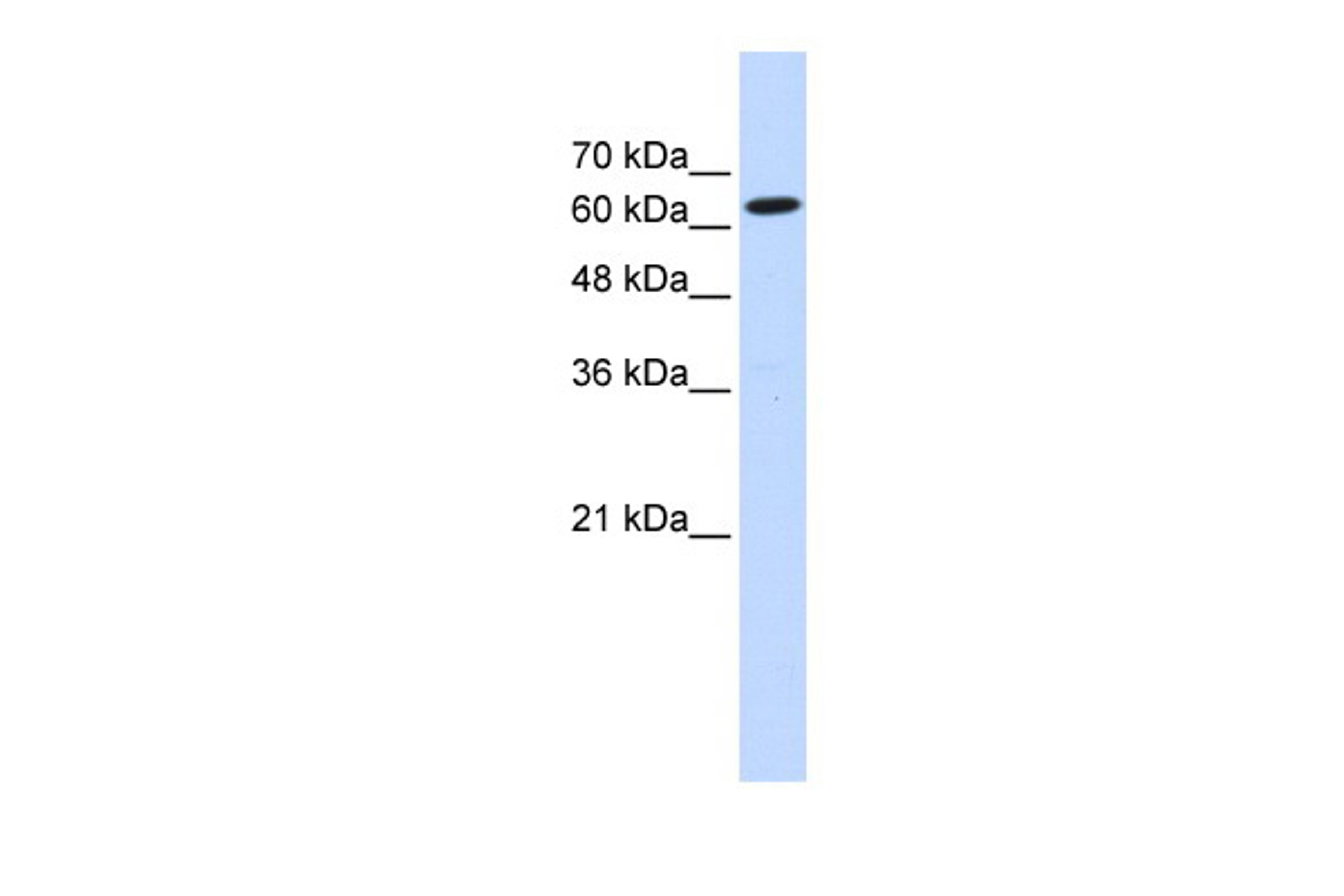 Antibody used in WB on Transfected 293T at 0.2-1 ug/ml.