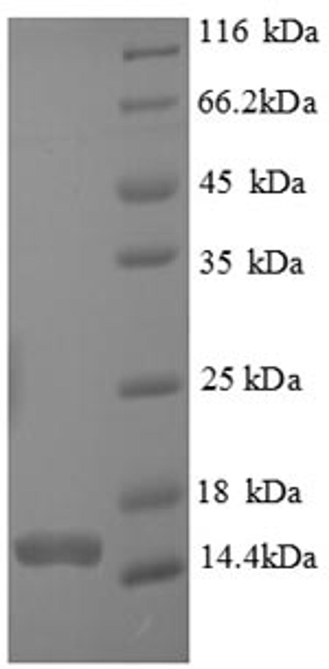 (Tris-Glycine gel) Discontinuous SDS-PAGE (reduced) with 5% enrichment gel and 15% separation gel.