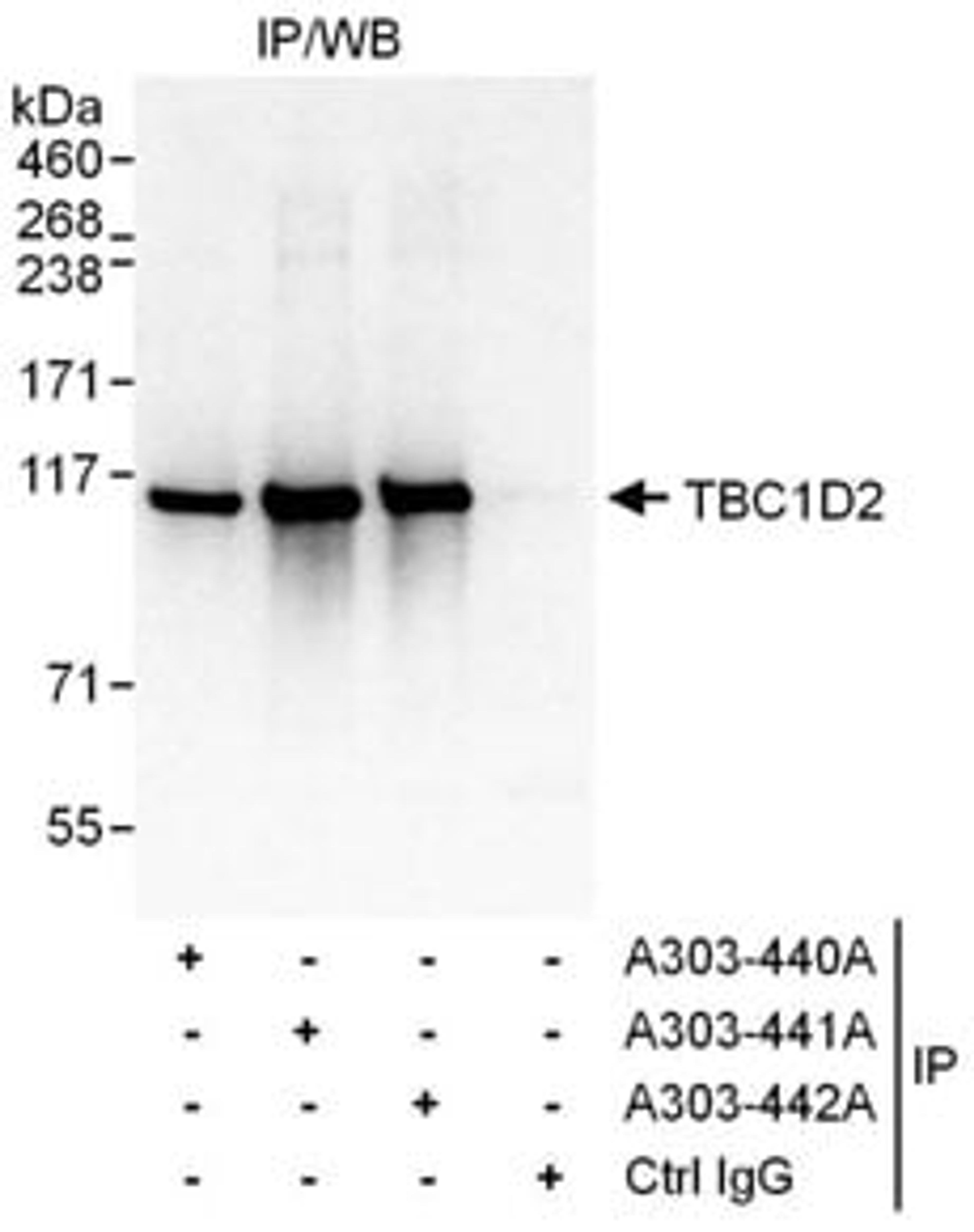 Detection of human TBC1D2 by western blot of immunoprecipitates.