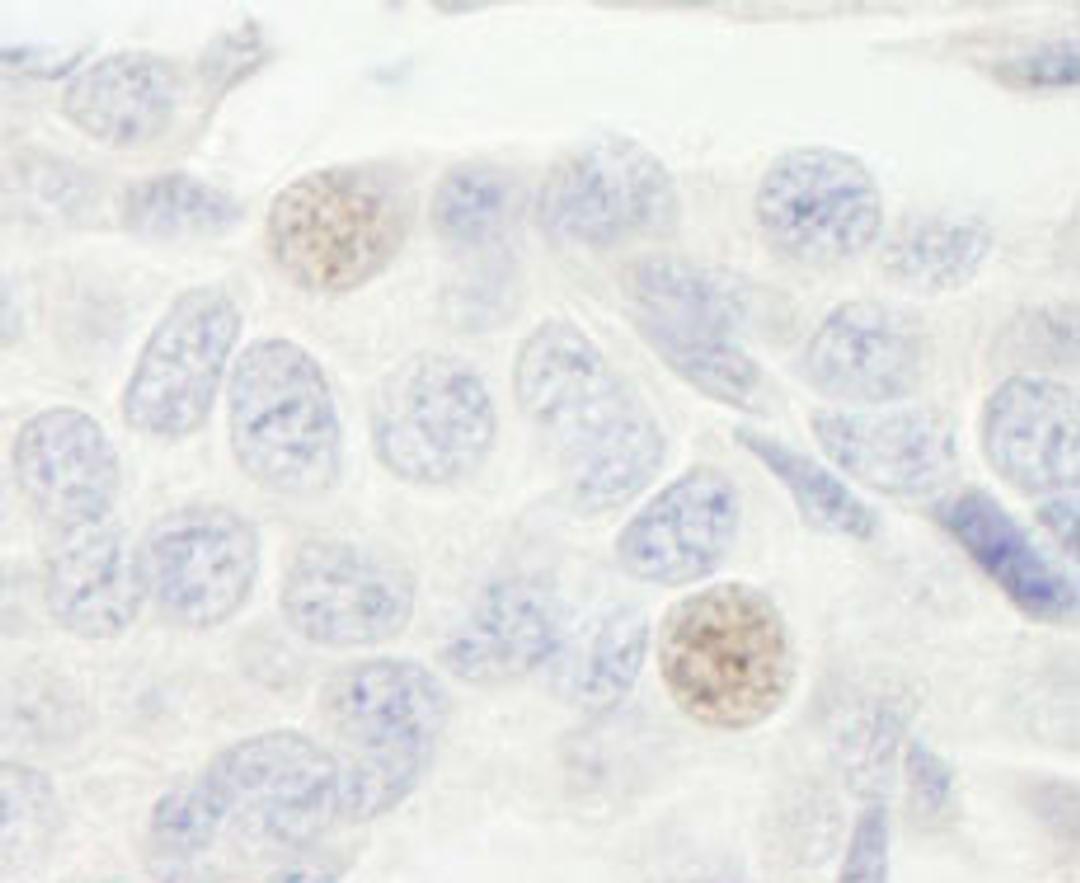 Detection of human GTF3C2/TFIIIC110 by immunohistochemistry.